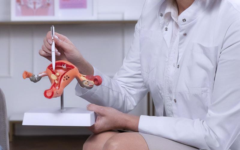 Doctora mostrando útero